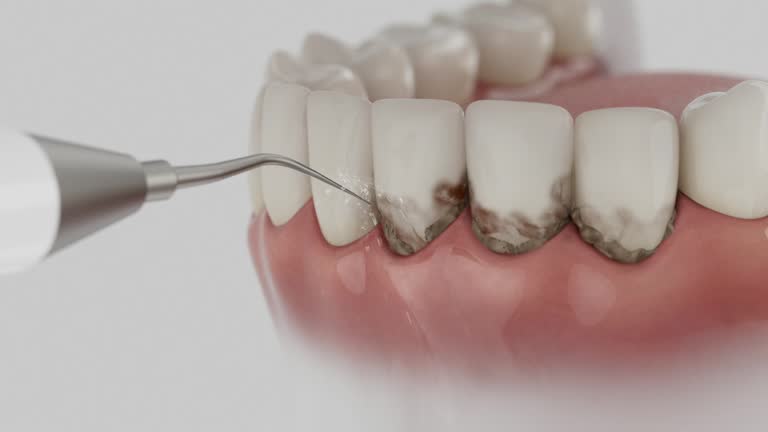 Trusted Wisdom Tooth Removal service in Ashland, WI - Dentist Open Now